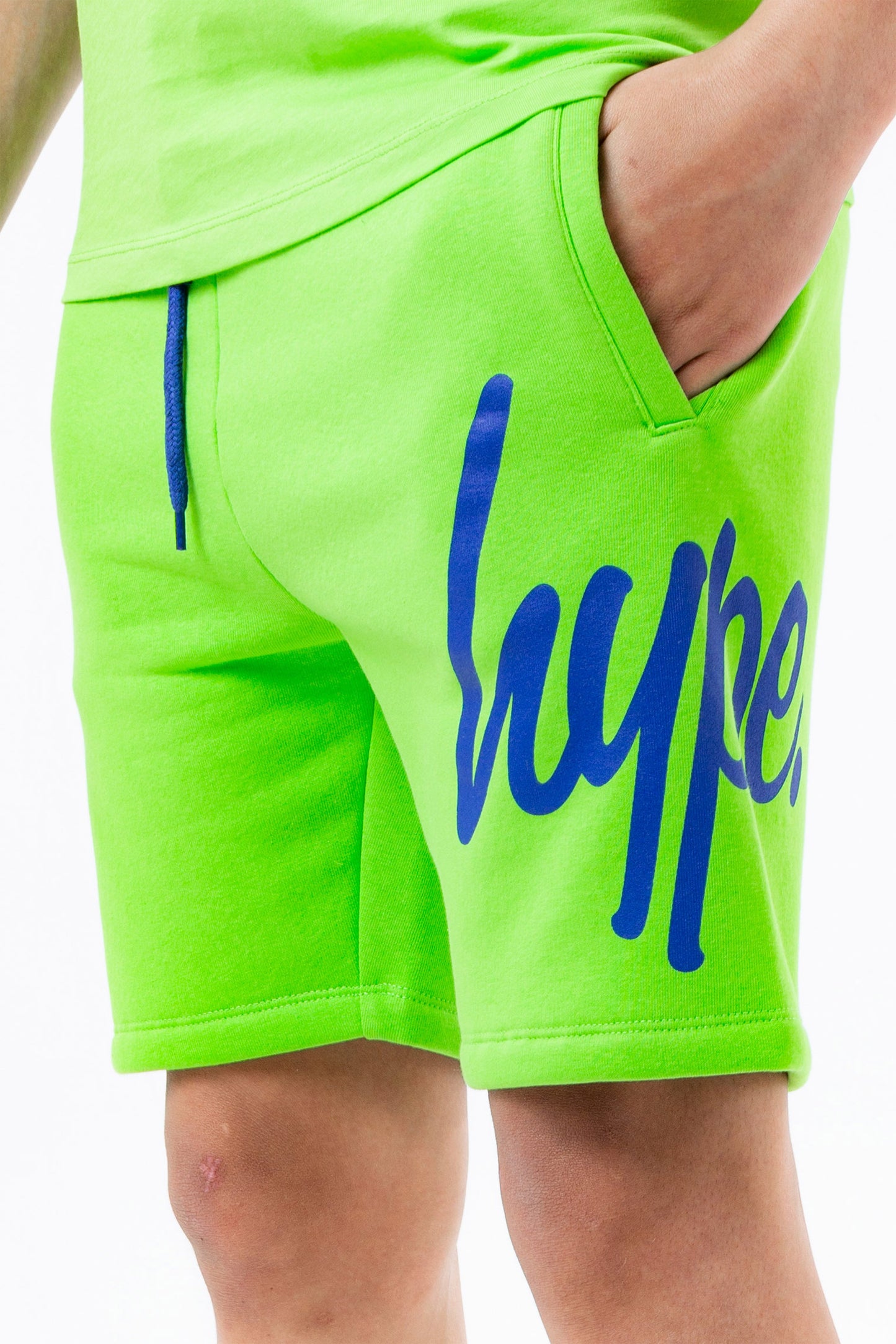 HYPE NEON GREEN KIDS SHORTS